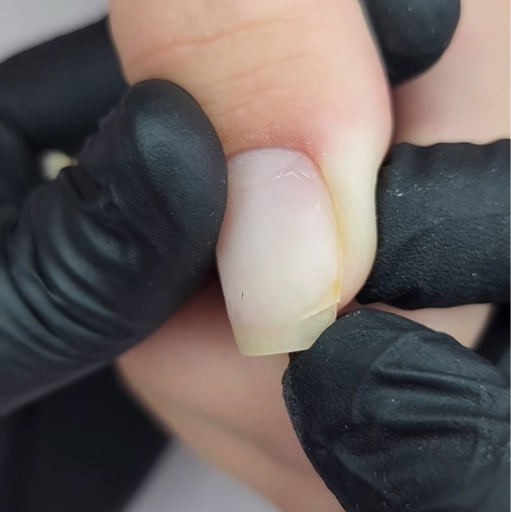 Ремонт одного ноготка