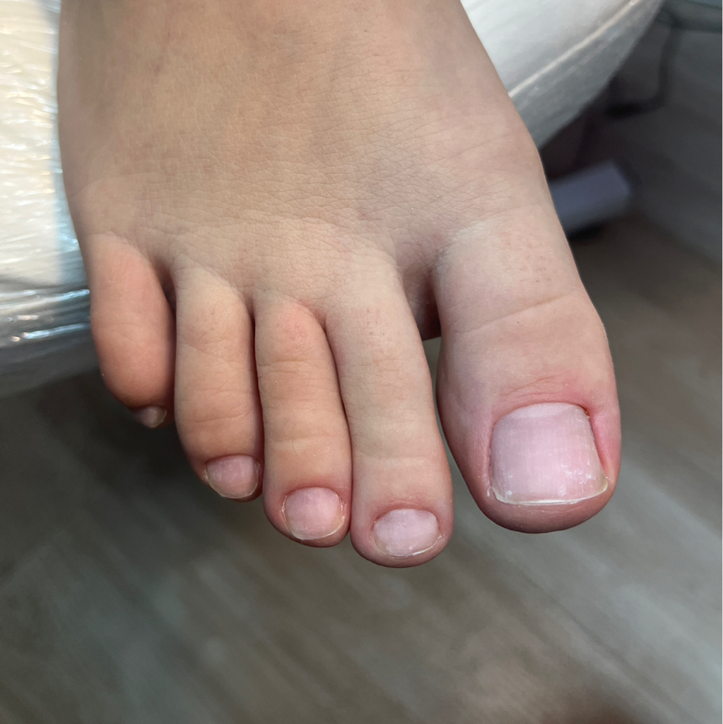 ПЕДИКЮР (гигиеническая обработка пальчиков)