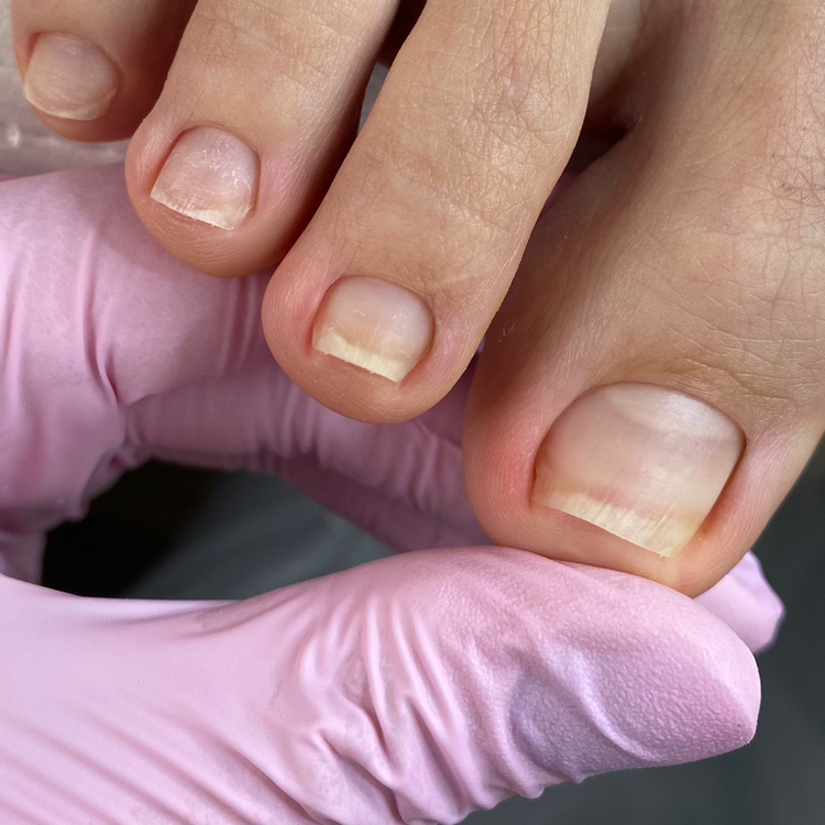 Педикюр пальцев без покрытия