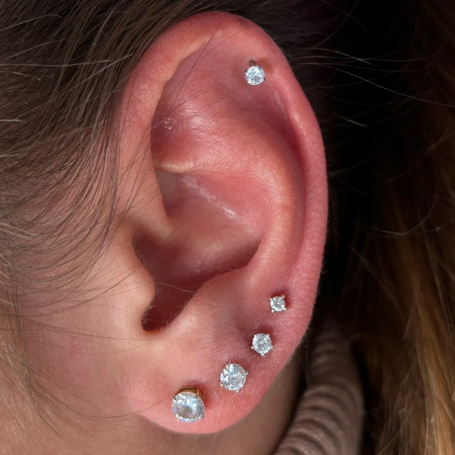 Прокол хряща уха иглой с катетером