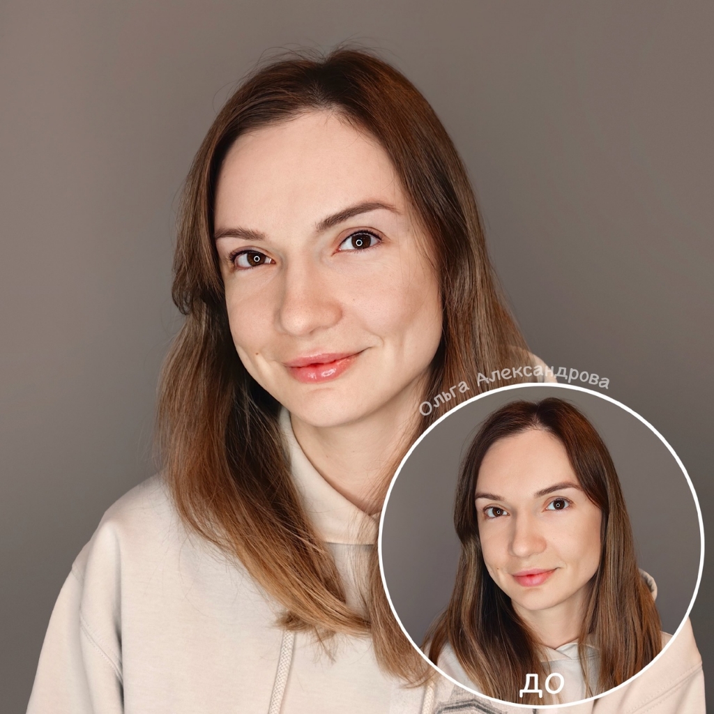 Межресничка