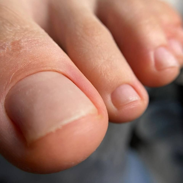 Педикюр гигиенический