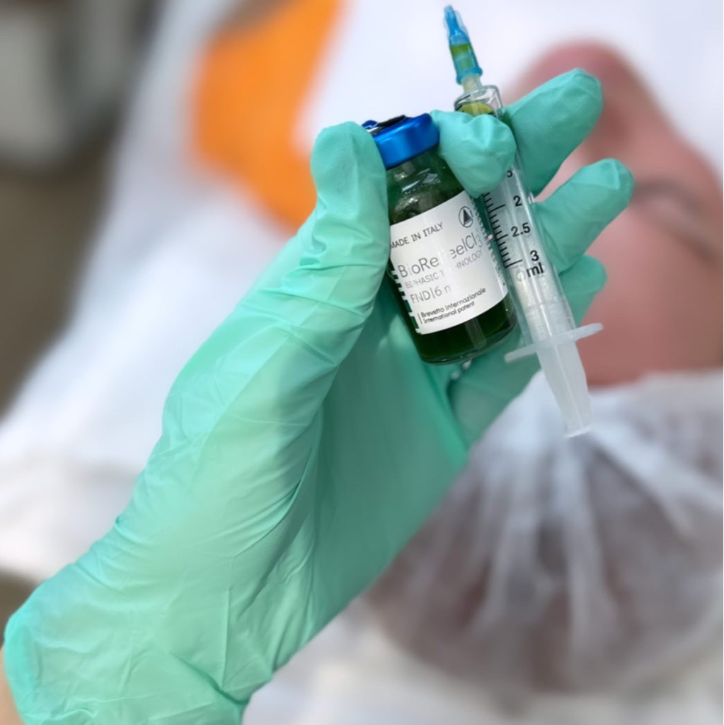 Пилинг лица