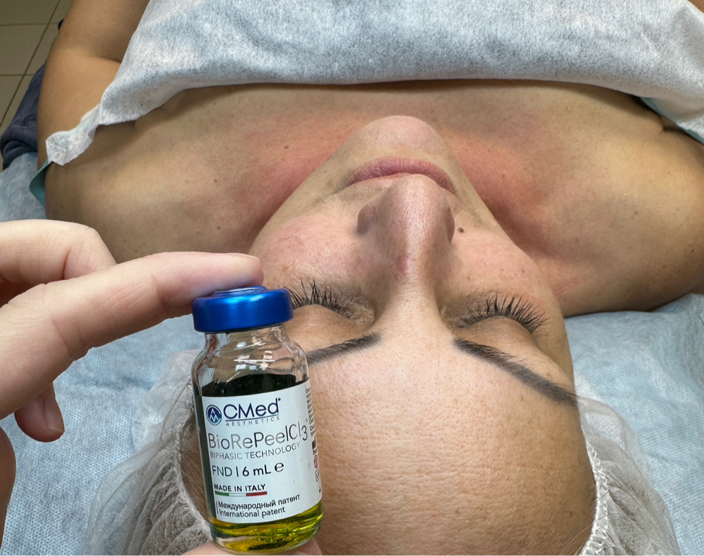 Пилинг Biorepeel