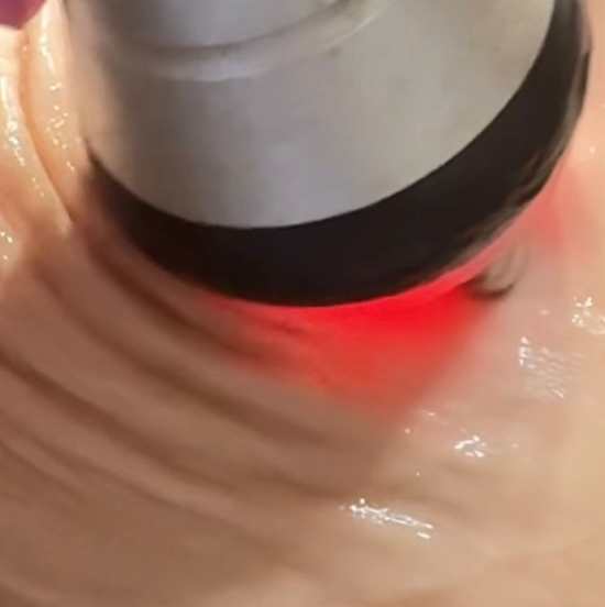 Красивый животик