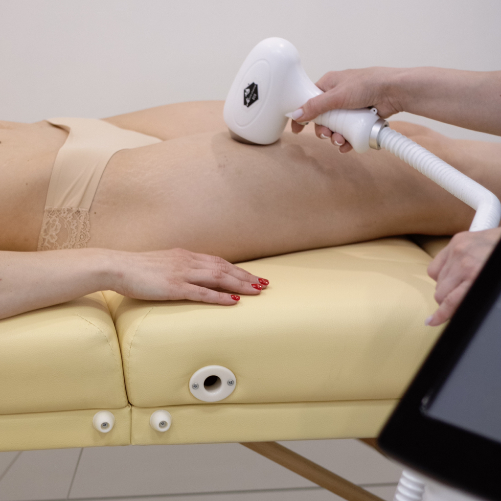 Лазерная эпиляция подмышки + бикини + голени