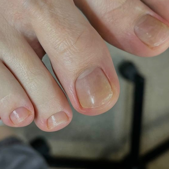 Педикюр пальчики без покрытия