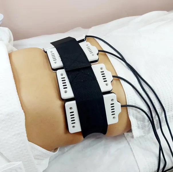 Лазерный липолиз