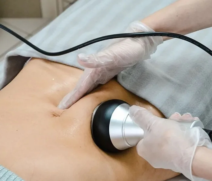 Кавитация ( без инъекционная липосакция)