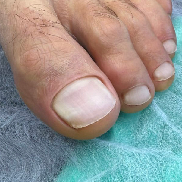 Мужской педикюр.