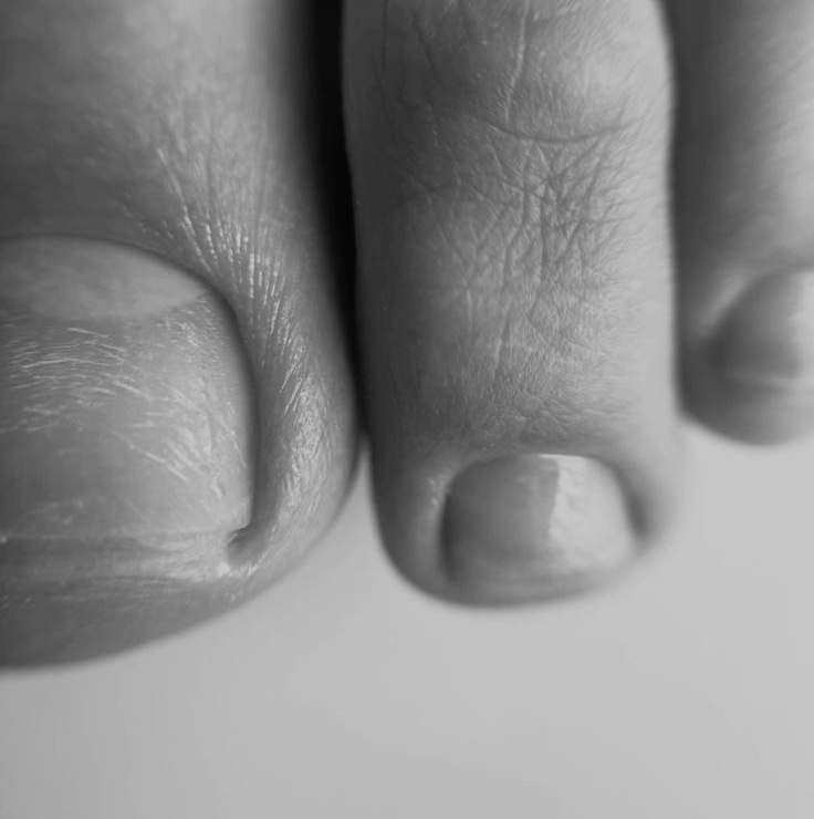 Педикюр пальчики