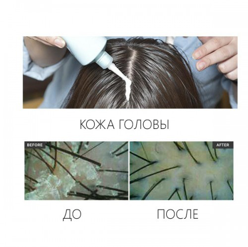 Скраб для кожи головы и волос(скраб+ мытье+ сушка)