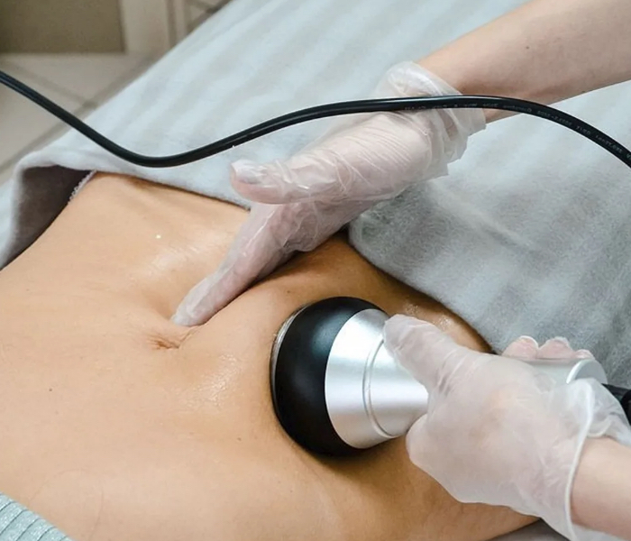 💎 Кавитация (одна зона на выбор: бедра, ягодицы или живот)