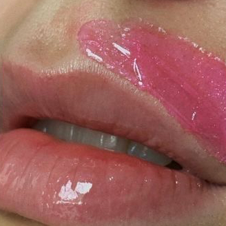 Восковая депиляция 1 зоны лица