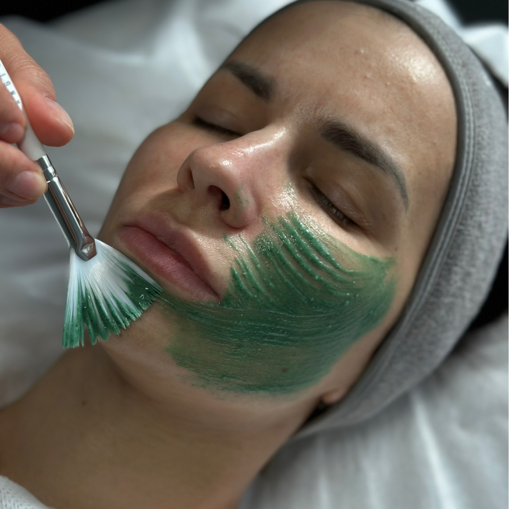 Сухая чистка при акне