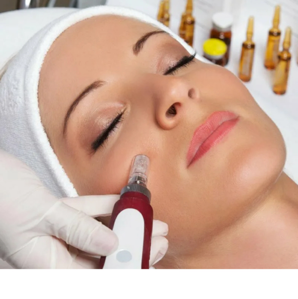 ОП - Фракционная мезотерапия лица