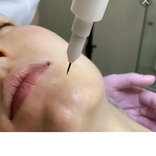 Лицо + Верхнее веко + Нижнее веко