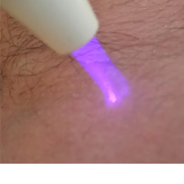 Шея (Кольца Венеры)