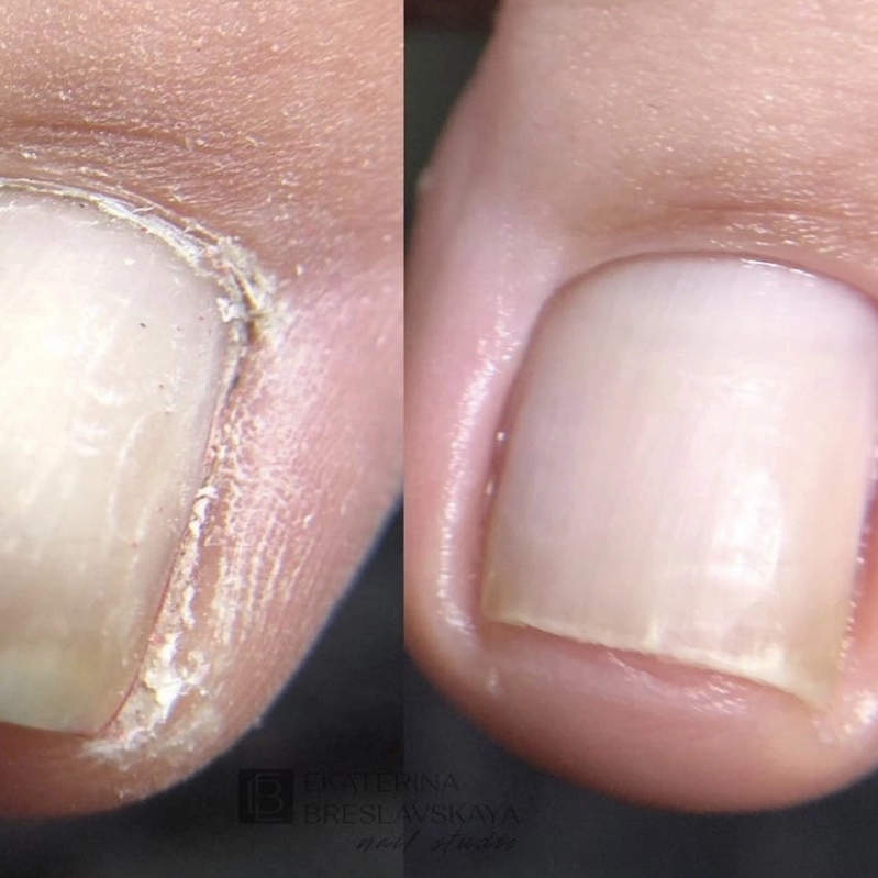 Педикюр без покрытия