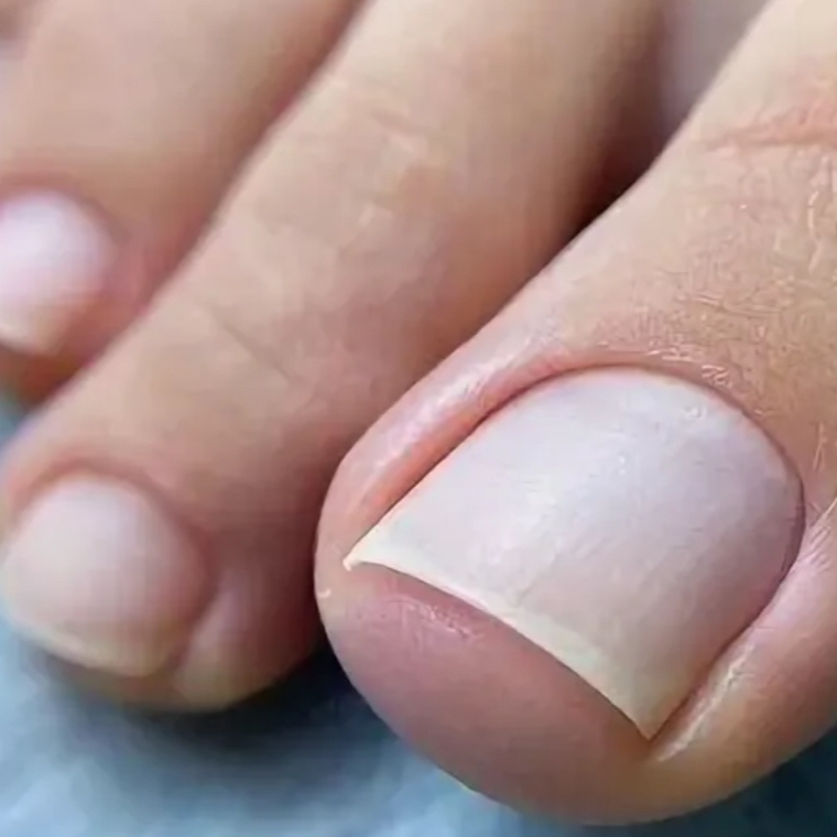 Педикюр аппаратный