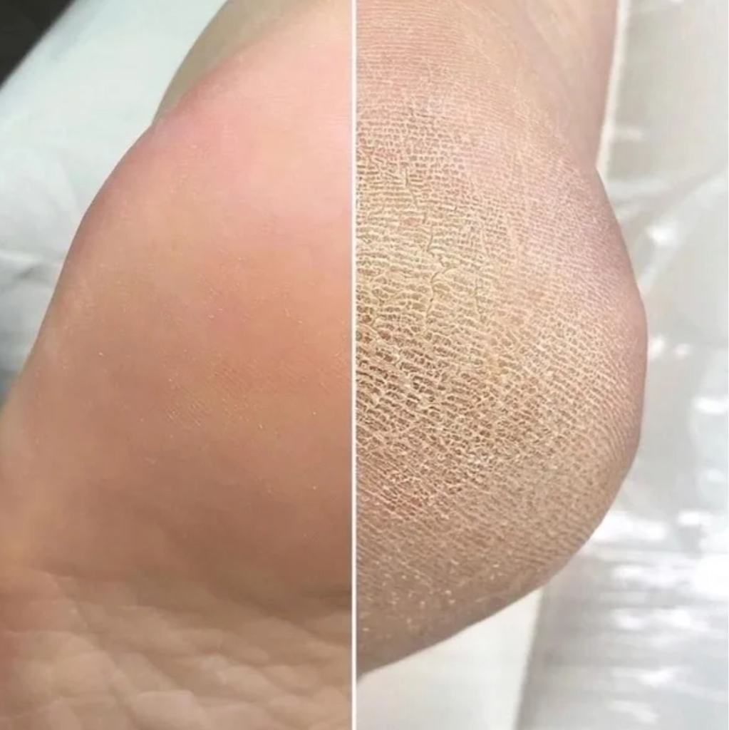 Обработка стоп