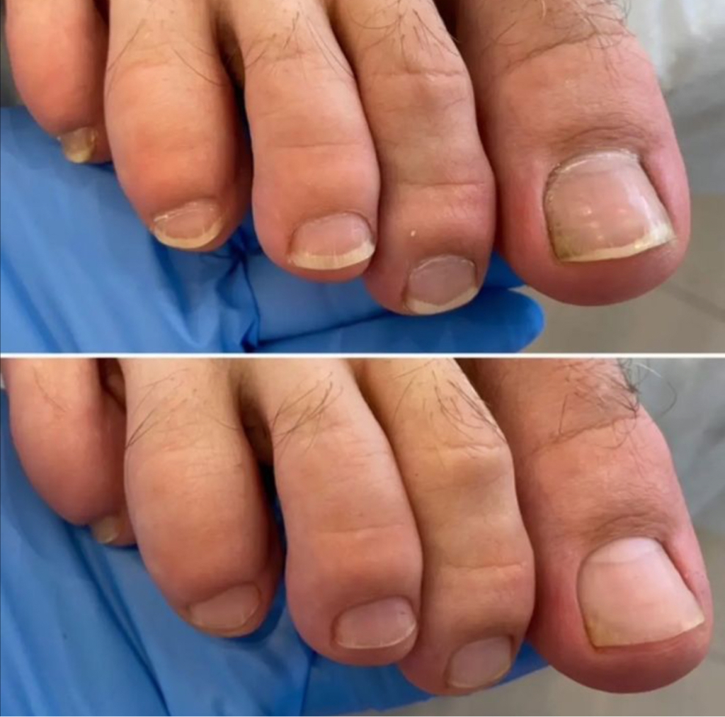 Мужской экспресс-педикюр