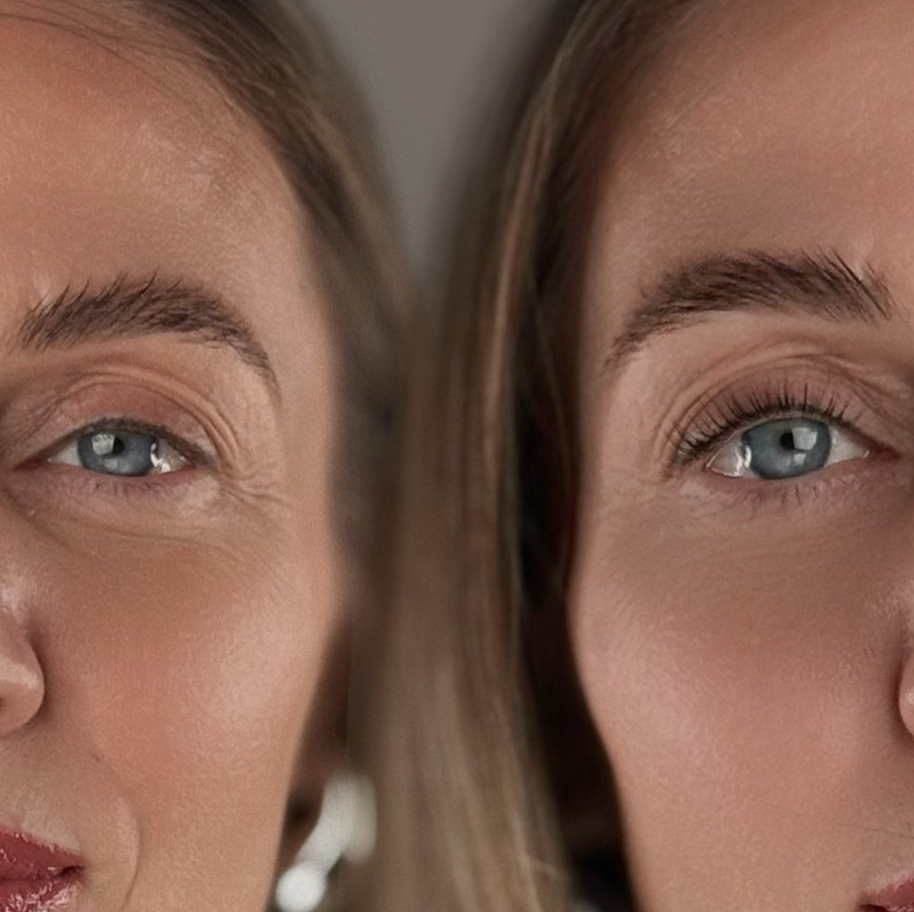 КОМПЛЕКС: ламинирование бровей+ламинирование ресниц. В ПОДАРОК ботокс для 2 зон