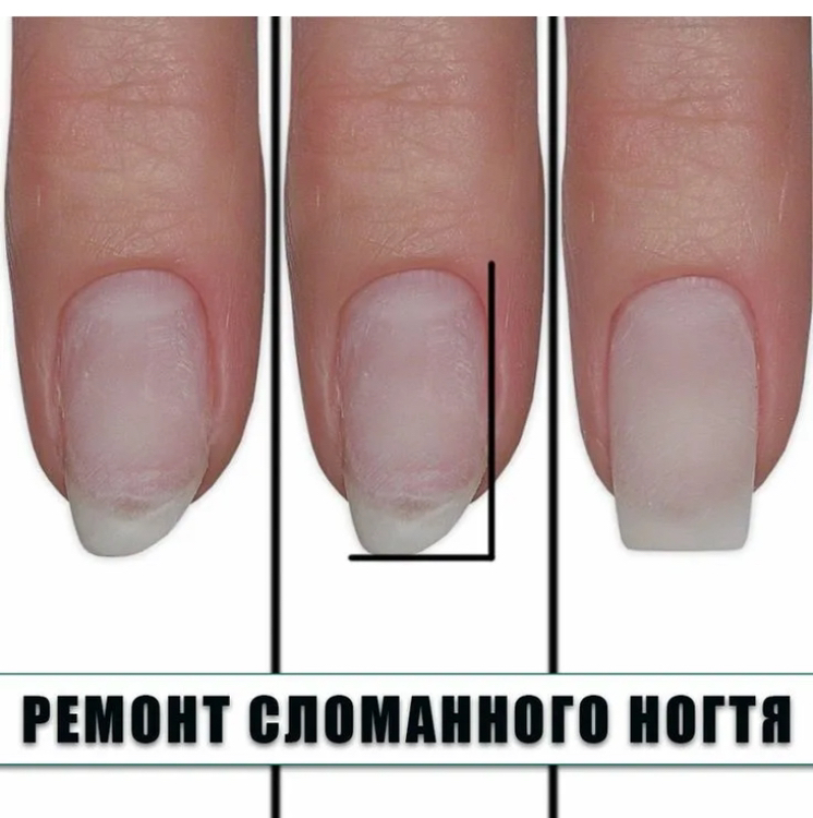 Ремонт , наращивание одного ногтя