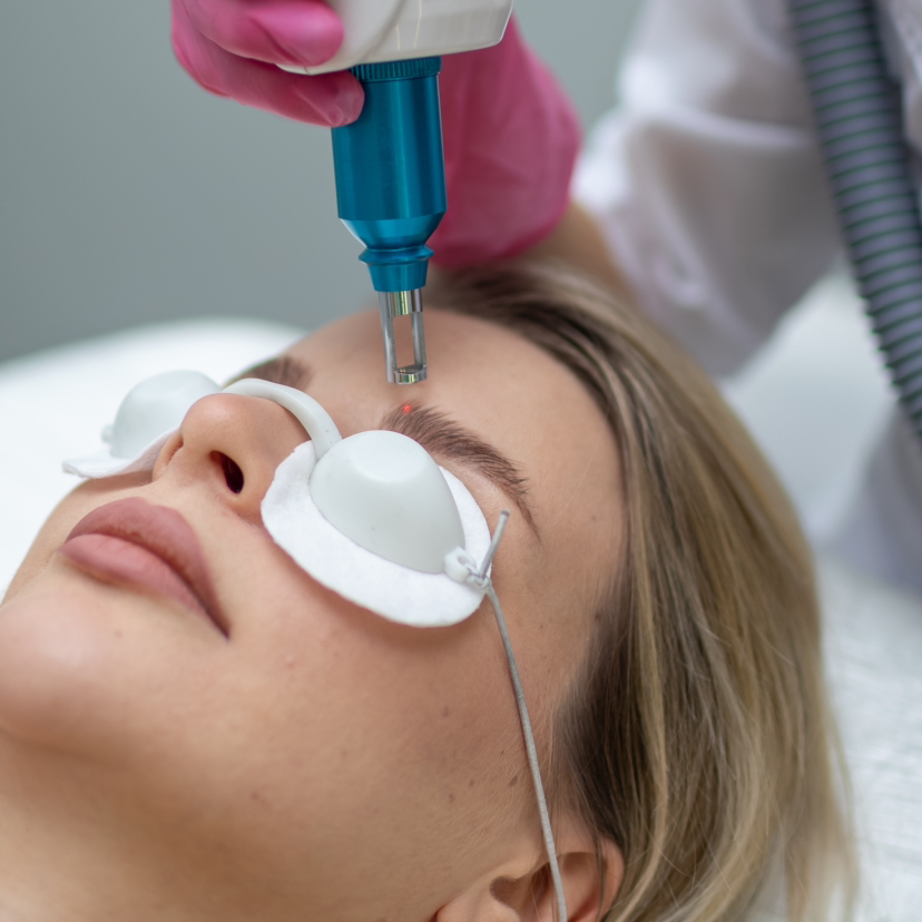 Лазерное удаление тату/татуажа