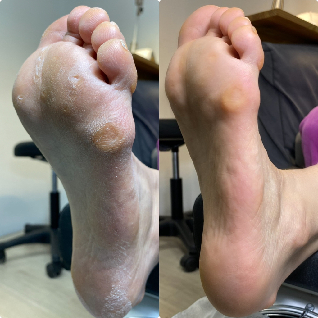 педикюр полный