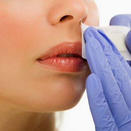 Восковая депиляция. Лицо.