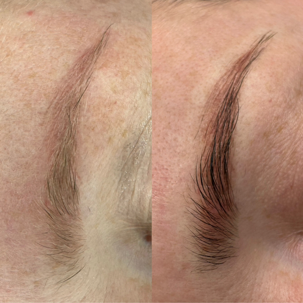 Удаление ремувером