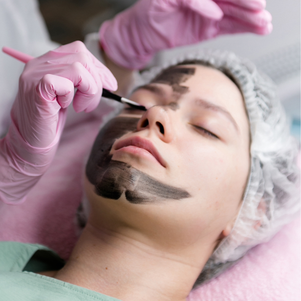 Карбоновый пилинг