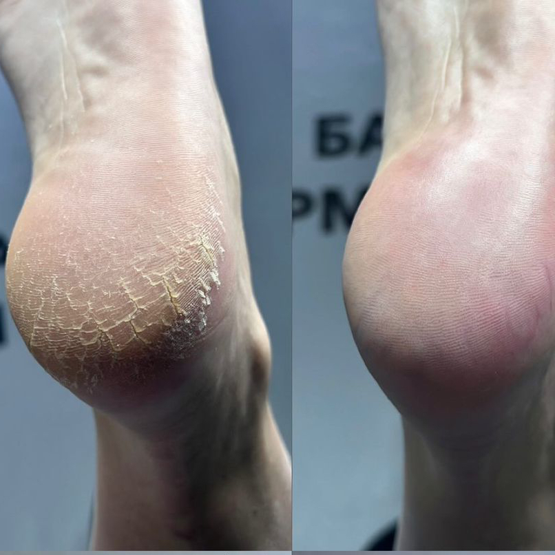 Педикюр со стопой без покрытия