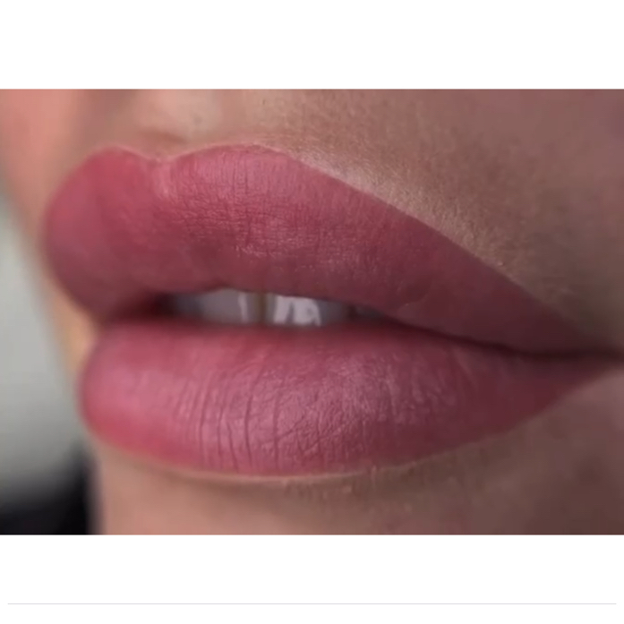 Коррекция губ