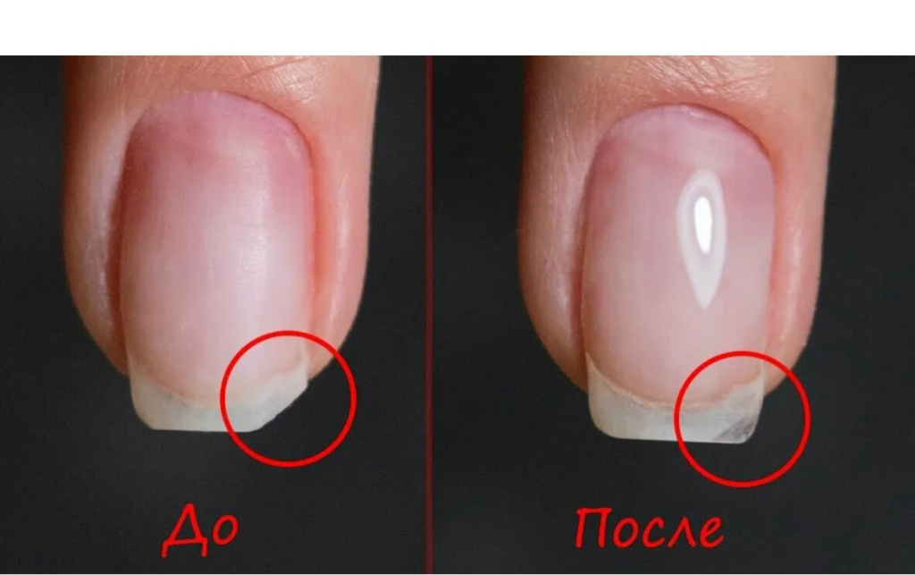 Наращивание ногтя, восстановление формы