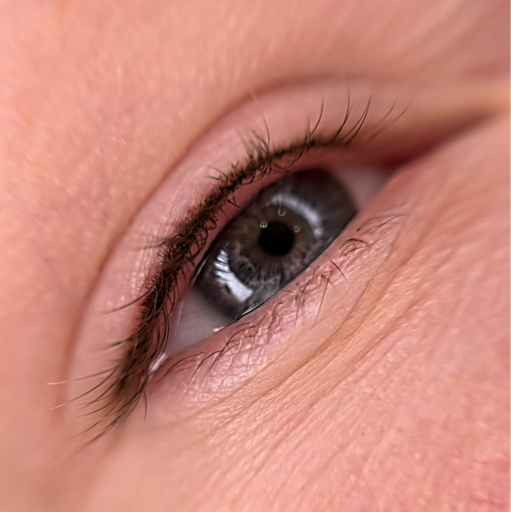 Коррекция межреснички