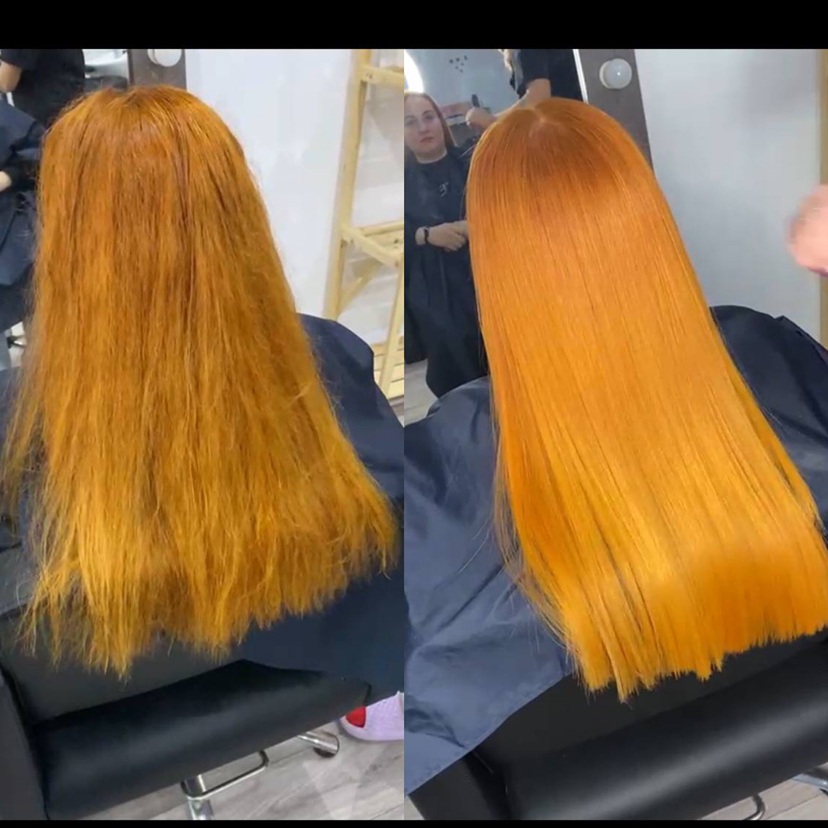 Биксипластия