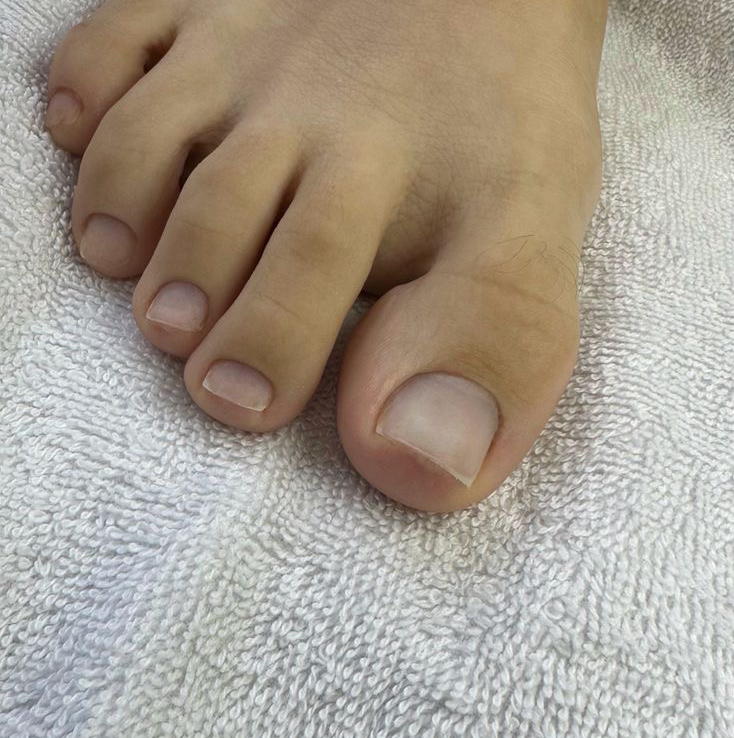 Придание формы ногтей на ногах