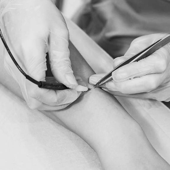 MEN Электроэпиляция 45 минут