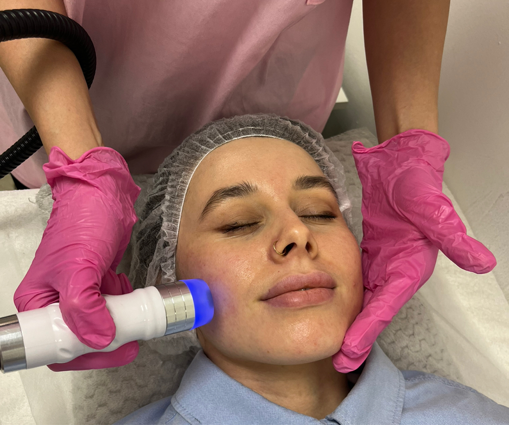 Вакуумный RF-лифтинг лица (20 мин)