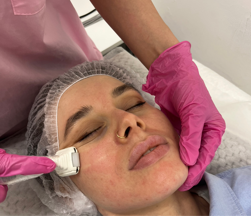 LPG массаж лица (20 мин)