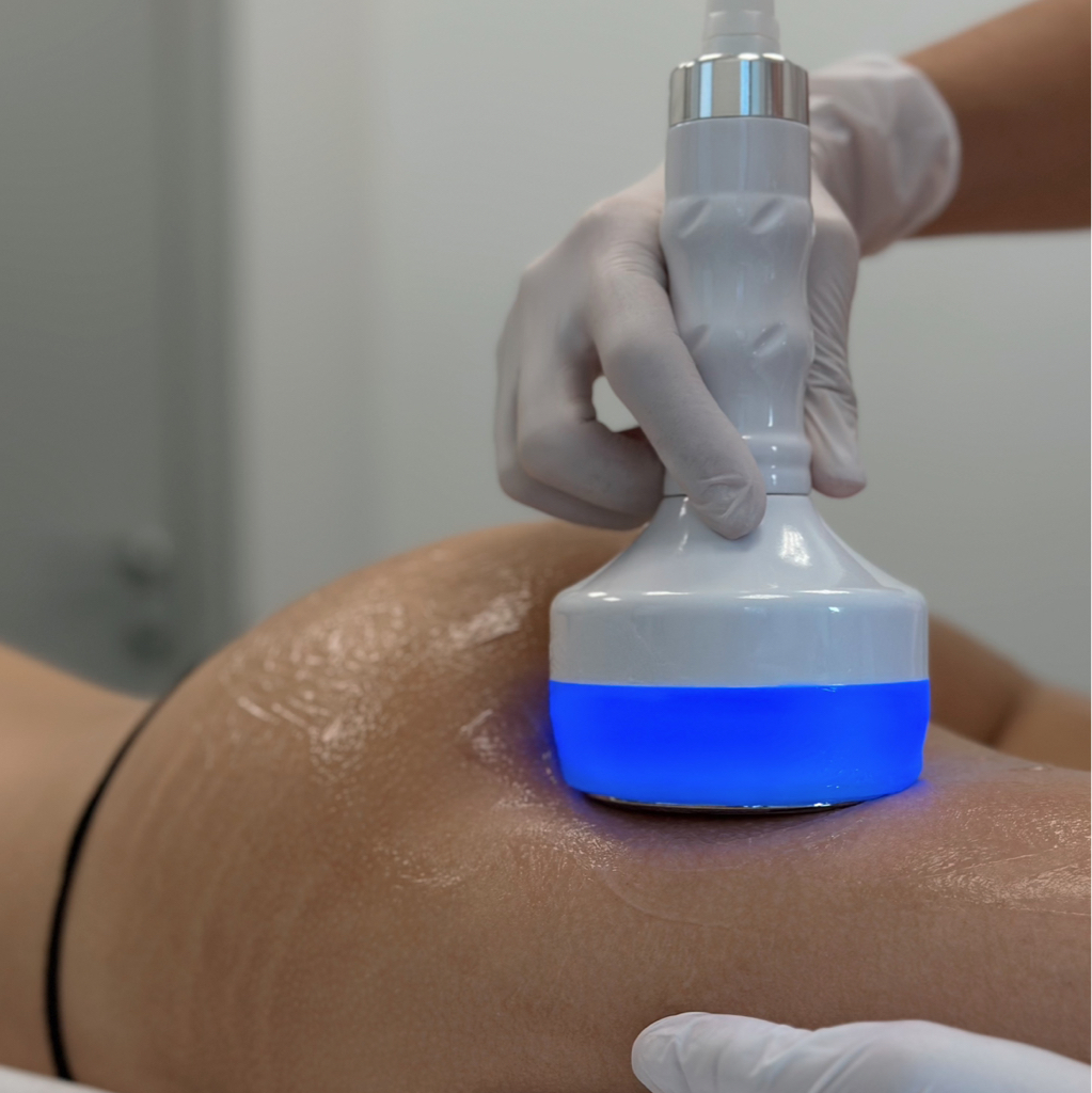 УЗ-кавитация на зону (20 мин)