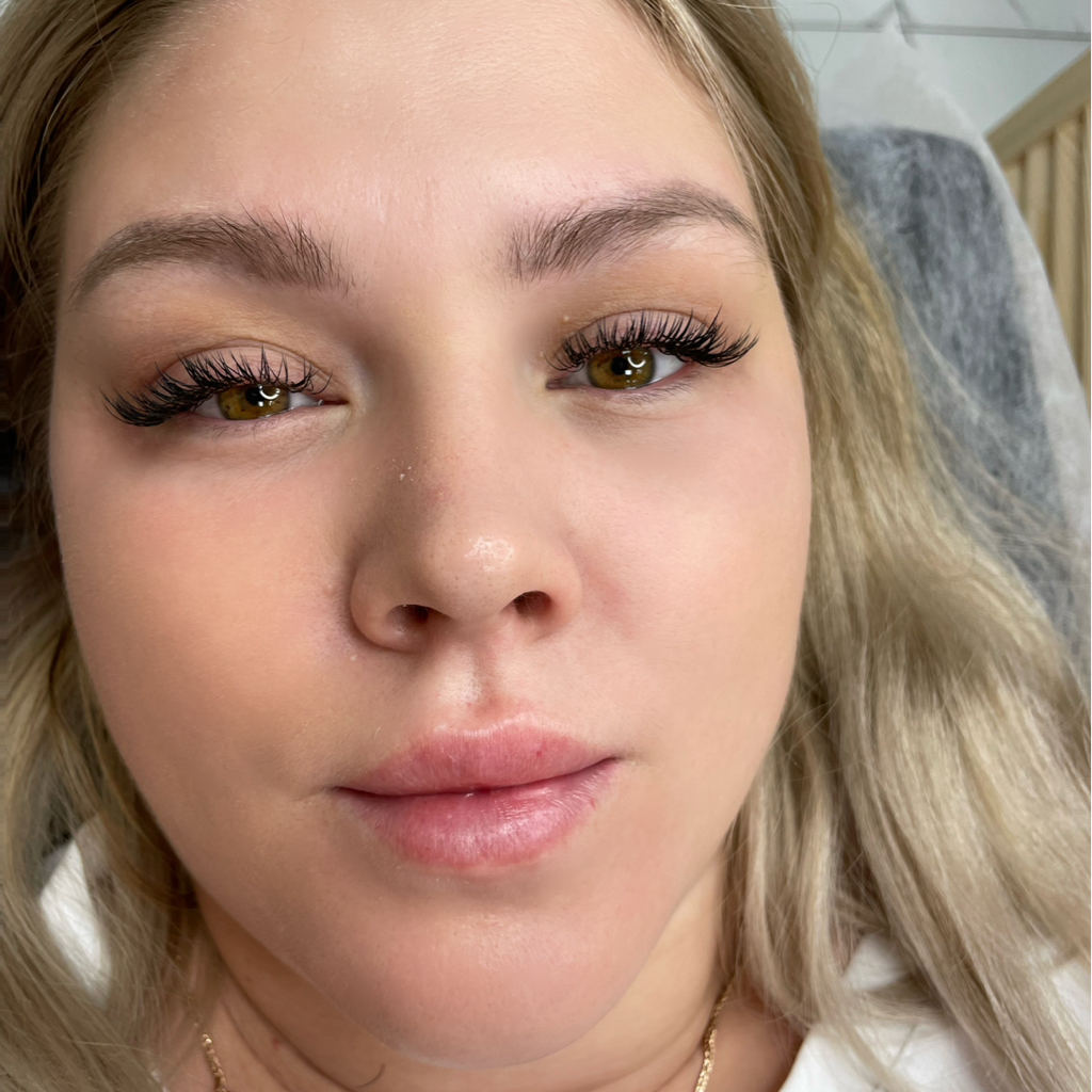 Уголки (отдельное наращивание)