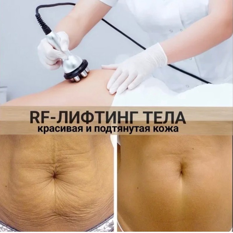 RF-лифтинг тела