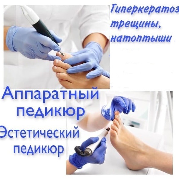 Медицинский педикюр