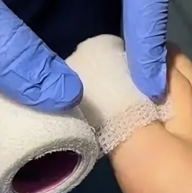 Повторный приём, обработка и антисептическая повязка