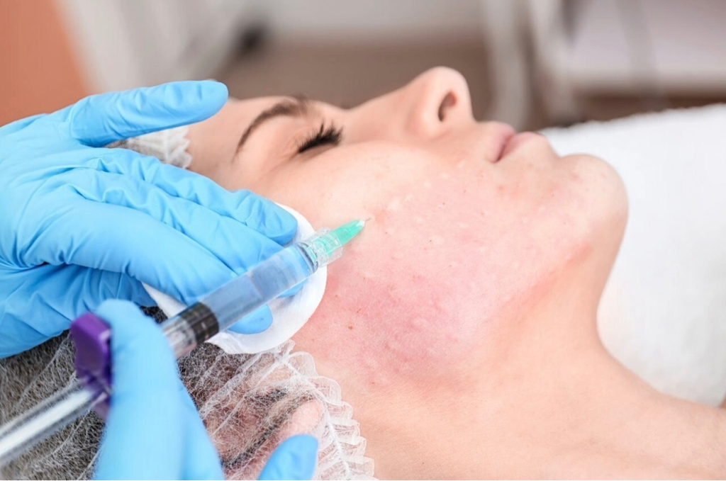 Биоревитализация