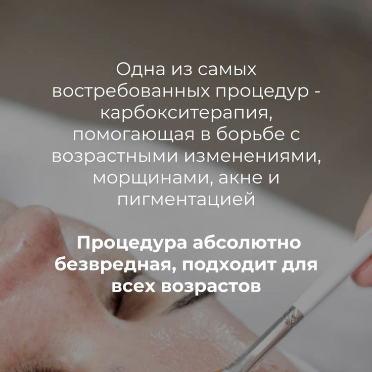 Карбокситерапия