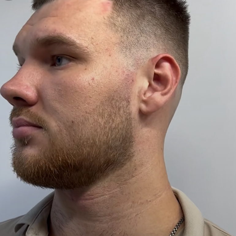 Оформление бороды и усов